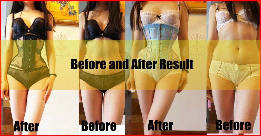 Best Corset Malaysia Before and After Result